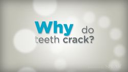 Why do teeth crack?