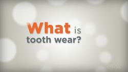 What is tooth wear?