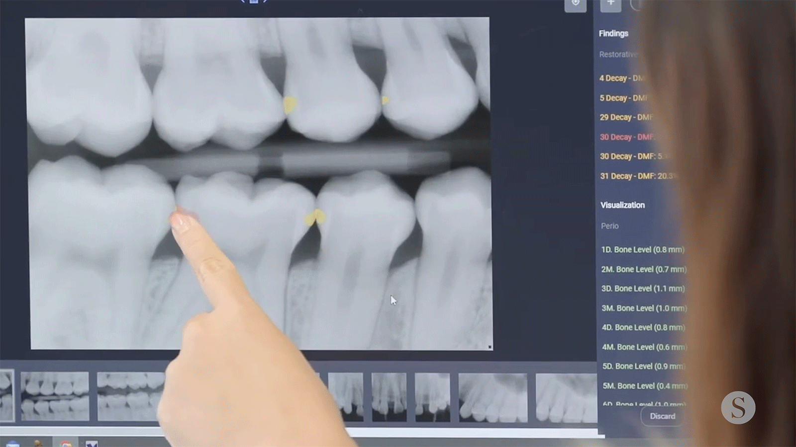 Reframing Trust: How AI and Computer Vision are Transforming the Dental ...