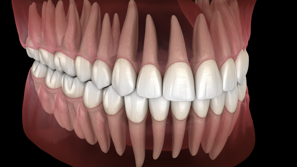 Advanced Occlusion | Spear Education