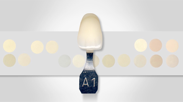 Creating a Custom Shade Guide | Spear Education