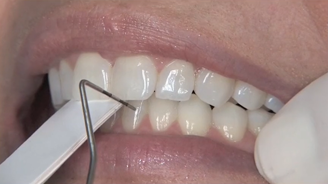 RESTORATIVE DESIGN & PRACTICAL OCCLUSIO… RESTORATIVE DENTISTRY – Occlusion Connections