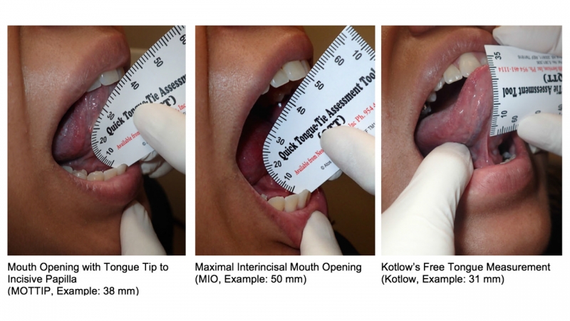 Creating a Pediatric Airway Data Gathering Protocol | Spear Education