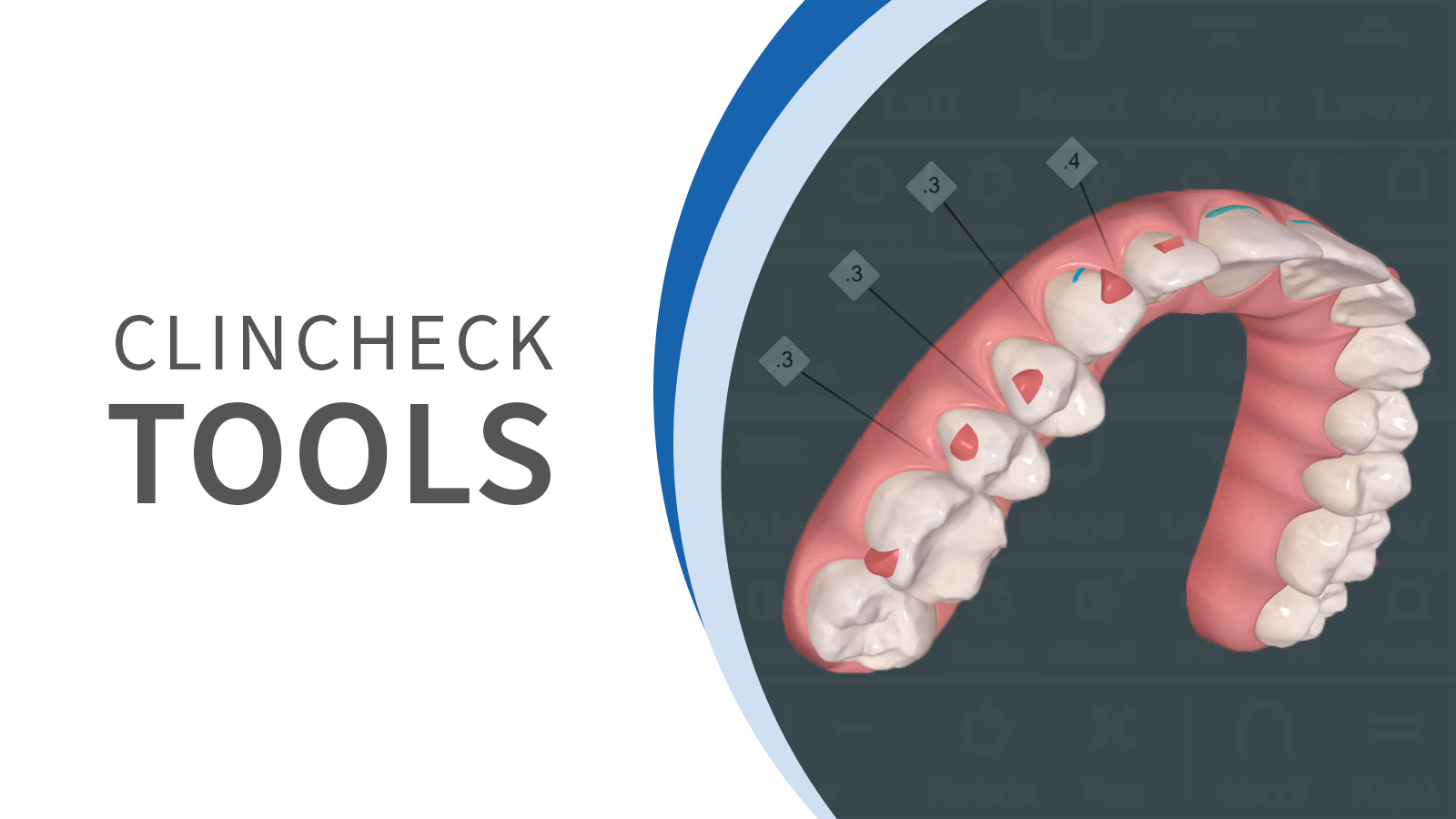ClinCheck Fundamentals: Maximizing Tools for Invisalign Treatment ...